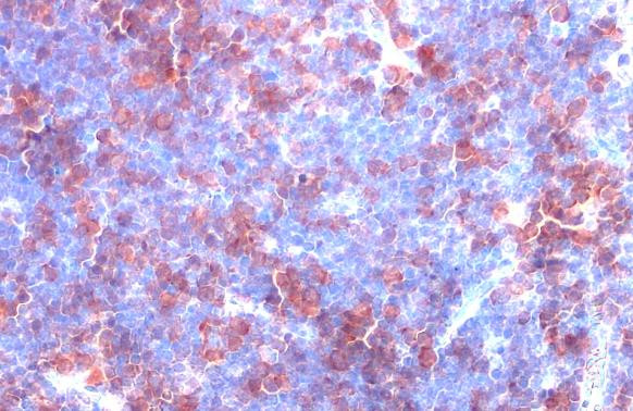 Thymidylate Synthase Antibody in Immunohistochemistry (Paraffin) (IHC (P))