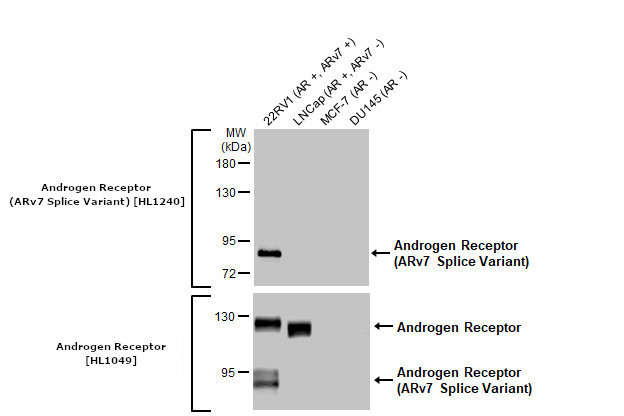 Androgen Receptor (ARv7 Splice Variant) Antibody in Western Blot (WB)