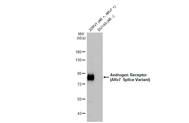 Androgen Receptor (ARv7 Splice Variant) Antibody in Western Blot (WB)