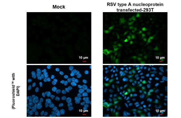 RSV NP Antibody in Immunocytochemistry (ICC/IF)