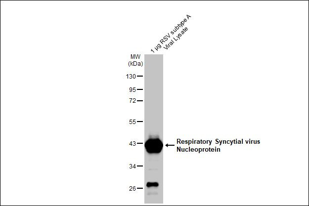 RSV NP Antibody in Western Blot (WB)