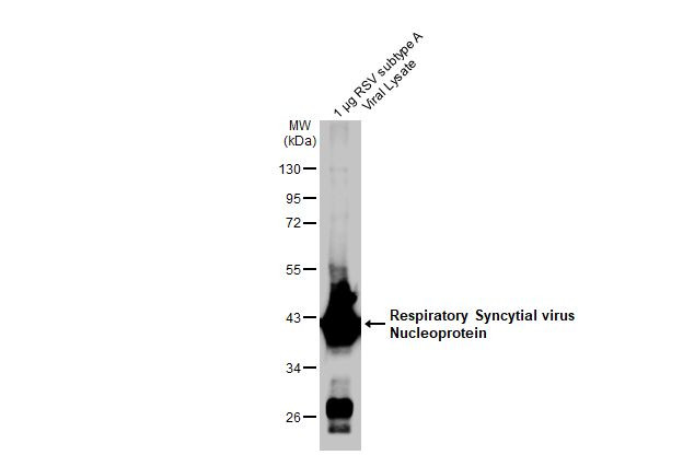 RSV NP Antibody in Western Blot (WB)