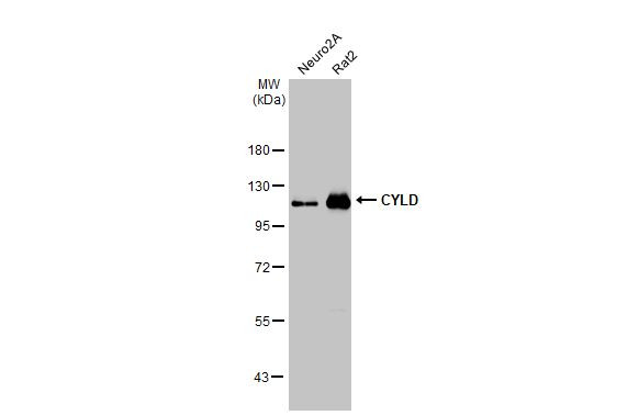 CYLD Antibody in Western Blot (WB)