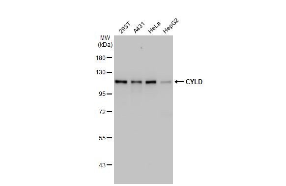 CYLD Antibody in Western Blot (WB)