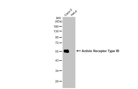 ACVR1B Antibody in Western Blot (WB)