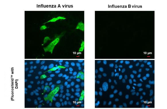 Influenza A M1 (A/Puerto Rico/8/1934) Antibody in Immunocytochemistry (ICC/IF)