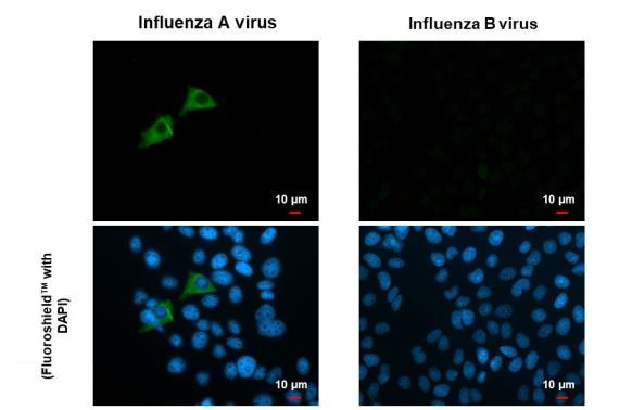 Influenza A M1 (A/Puerto Rico/8/1934) Antibody in Immunocytochemistry (ICC/IF)