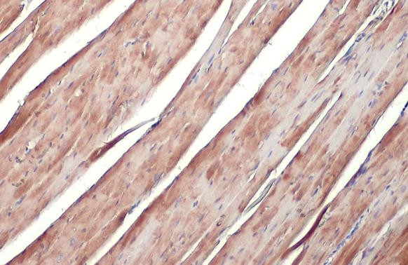 V-ATPase H Antibody in Immunohistochemistry (Paraffin) (IHC (P))