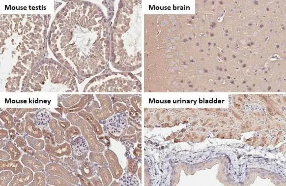 V-ATPase H Antibody in Immunohistochemistry (Paraffin) (IHC (P))