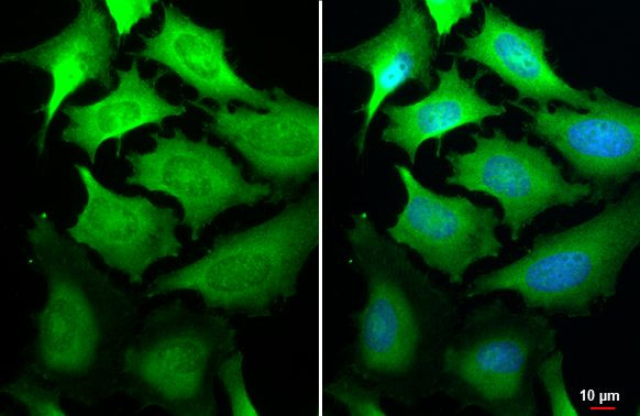 GSPT1 Antibody in Immunocytochemistry (ICC/IF)