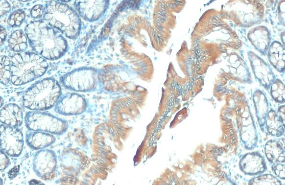 GSPT1 Antibody in Immunohistochemistry (Paraffin) (IHC (P))