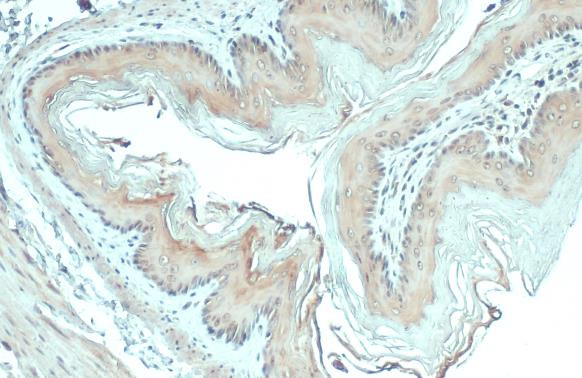 GSPT1 Antibody in Immunohistochemistry (Paraffin) (IHC (P))