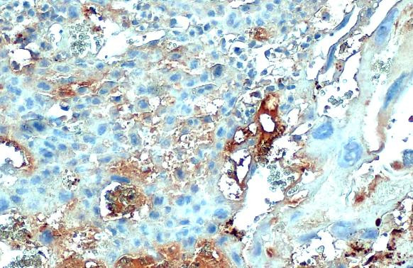 COL4A1 Antibody in Immunohistochemistry (Paraffin) (IHC (P))