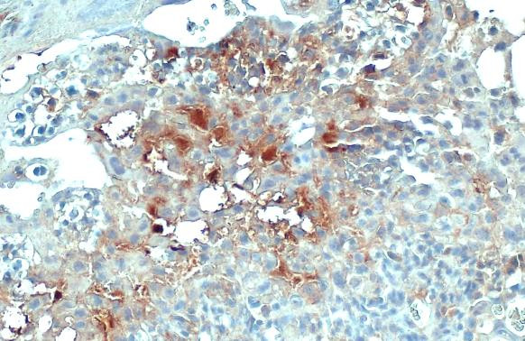 COL4A1 Antibody in Immunohistochemistry (Paraffin) (IHC (P))