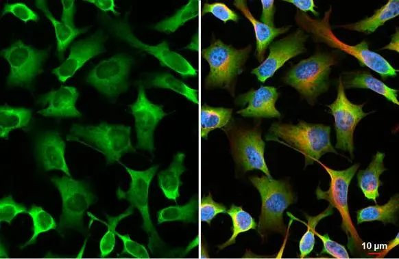 YTHDF2 Antibody in Immunocytochemistry (ICC/IF)