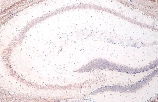 YTHDF2 Antibody in Immunohistochemistry (Paraffin) (IHC (P))