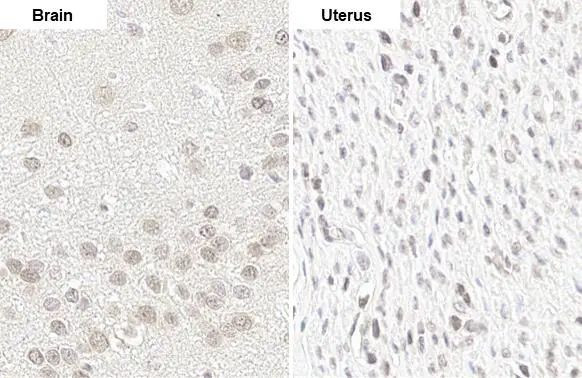 YTHDF2 Antibody in Immunohistochemistry (Paraffin) (IHC (P))