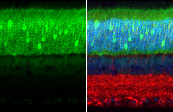 PDE6D Antibody in Immunohistochemistry (Paraffin) (IHC (P))