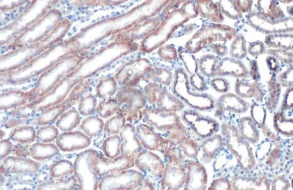 STAR Antibody in Immunohistochemistry (Paraffin) (IHC (P))