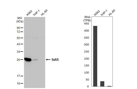 STAR Antibody in Western Blot (WB)