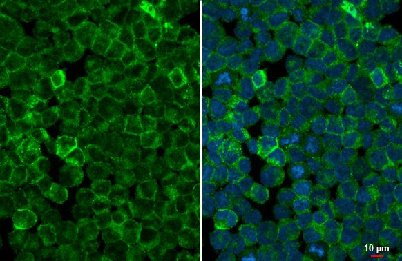 STAR Antibody in Immunocytochemistry (ICC/IF)