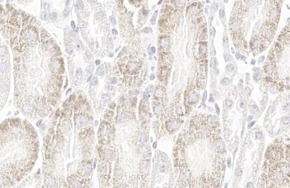 STAR Antibody in Immunohistochemistry (Paraffin) (IHC (P))