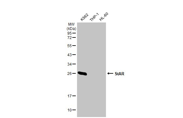 STAR Antibody in Western Blot (WB)