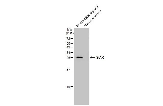 STAR Antibody in Western Blot (WB)