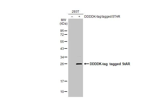 STAR Antibody in Western Blot (WB)