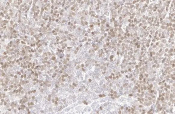 PARP1 Antibody in Immunohistochemistry (Paraffin) (IHC (P))