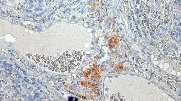 PARP1 Antibody in Immunohistochemistry (Paraffin) (IHC (P))