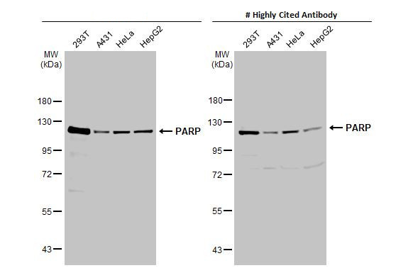 PARP1 Antibody in Western Blot (WB)