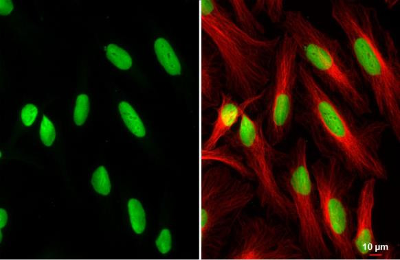 PARP1 Antibody in Immunocytochemistry (ICC/IF)