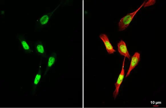 MYOD Antibody in Immunocytochemistry (ICC/IF)