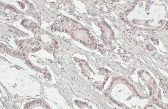 MRE11 Antibody in Immunohistochemistry (Paraffin) (IHC (P))