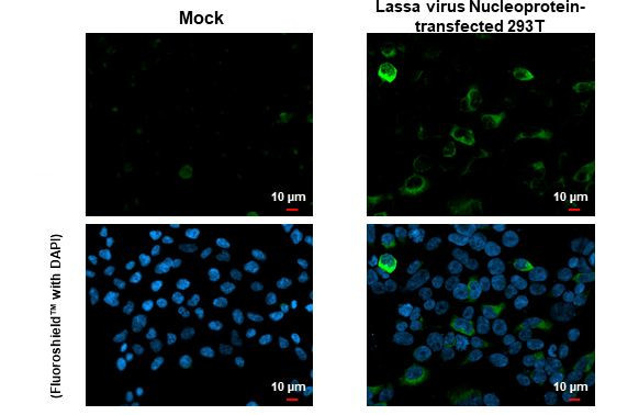 Lassa Virus Nucleoprotein Antibody in Immunocytochemistry (ICC/IF)