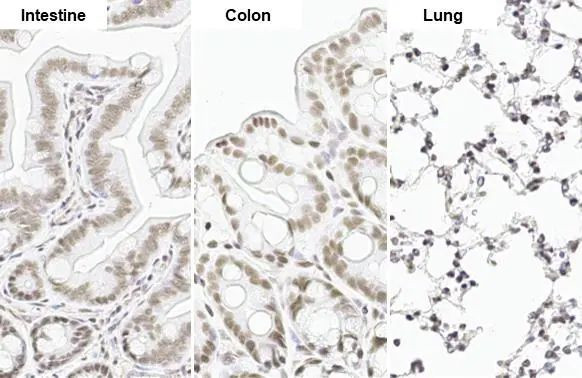 SP1 Antibody in Immunohistochemistry (Paraffin) (IHC (P))