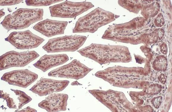 PI3K p85 alpha Antibody in Immunohistochemistry (Paraffin) (IHC (P))