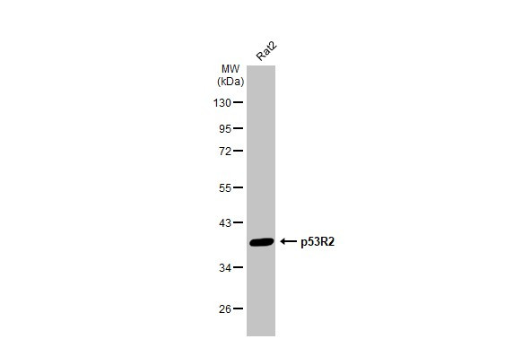 p53R2 Antibody in Western Blot (WB)