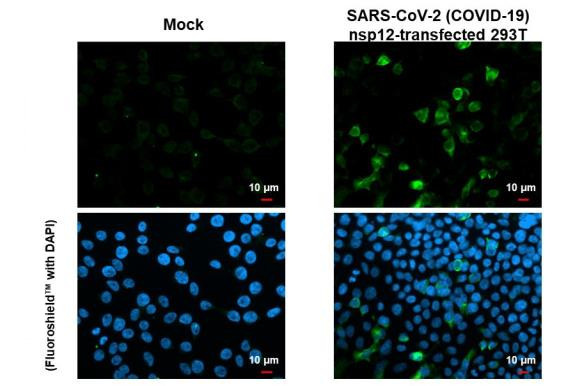 SARS-CoV-2 NSP12 Antibody in Immunocytochemistry (ICC/IF)