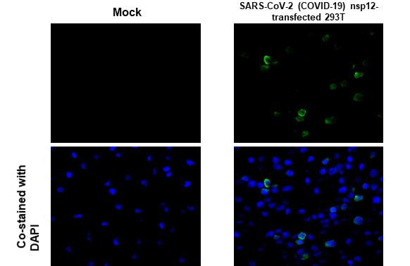 SARS-CoV-2 NSP12 Antibody in Immunocytochemistry (ICC/IF)