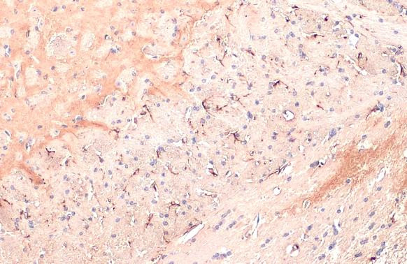 IL-1 beta Antibody in Immunohistochemistry (Paraffin) (IHC (P))