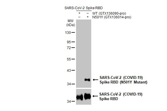 SARS-CoV-2 Spike (N501Y Mutant) Antibody in Western Blot (WB)