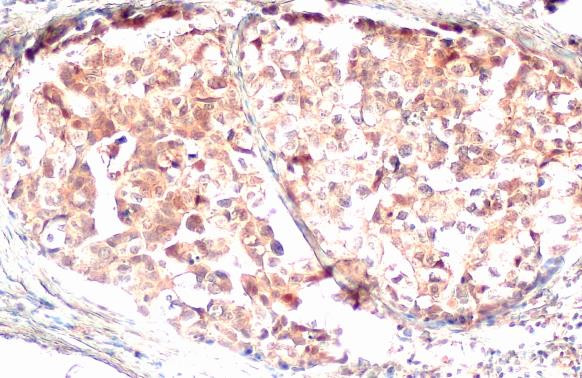 GSDMD Antibody in Immunohistochemistry (Paraffin) (IHC (P))