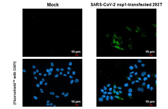 SARS-CoV-2 NSP1 Antibody in Immunocytochemistry (ICC/IF)