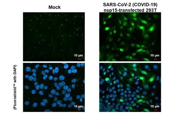 SARS-CoV-2 NSP15 Antibody in Immunocytochemistry (ICC/IF)