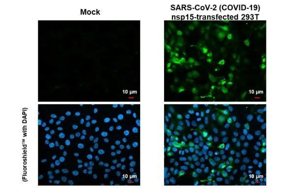 SARS-CoV-2 NSP15 Antibody in Immunocytochemistry (ICC/IF)