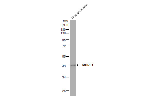 MURF1 Antibody in Western Blot (WB)