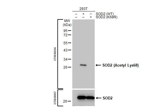 Acetyl-SOD2 (Lys68) Antibody in Western Blot (WB)