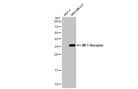 MC1R Antibody in Western Blot (WB)